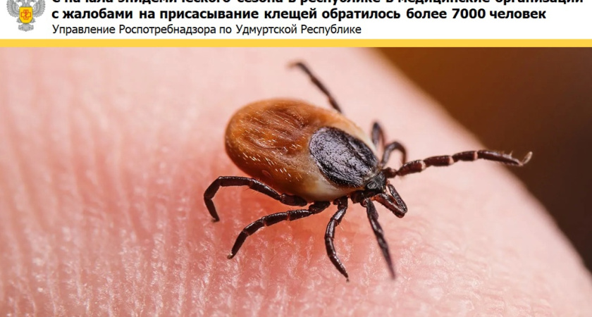 Примерно 10 человек из Глазова и района ежедневно обращаются за помощью после укусов клещей