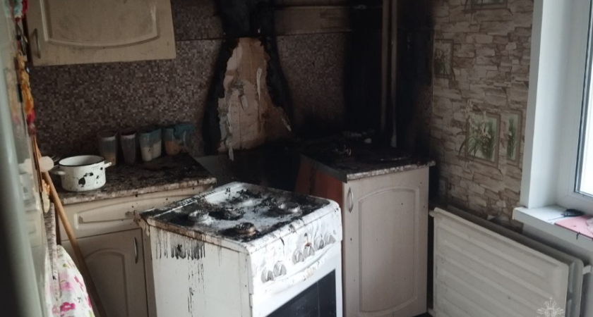 Пенсионерка едва не погибла на пожаре в Удмуртии