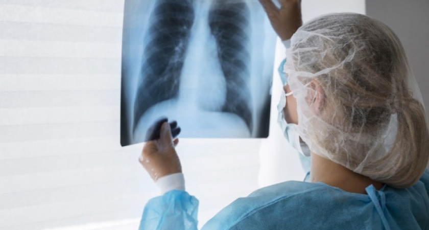 408 случаев рака легких было выявлено с начала года в Удмуртии