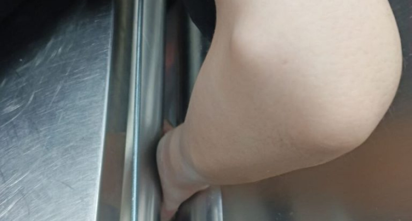 Спасатели оказали помощь работнику ижевского кафе