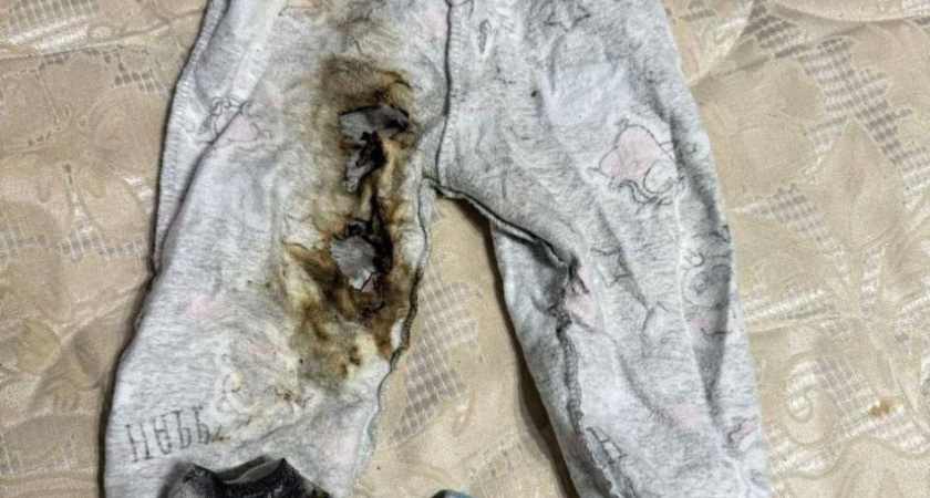 9-месячный малыш пострадал из-за загоревшегося телефона в Удмуртии