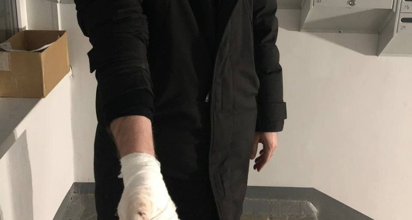 В Ижевске 25 летний мужчина получил травму руки из-за петарды