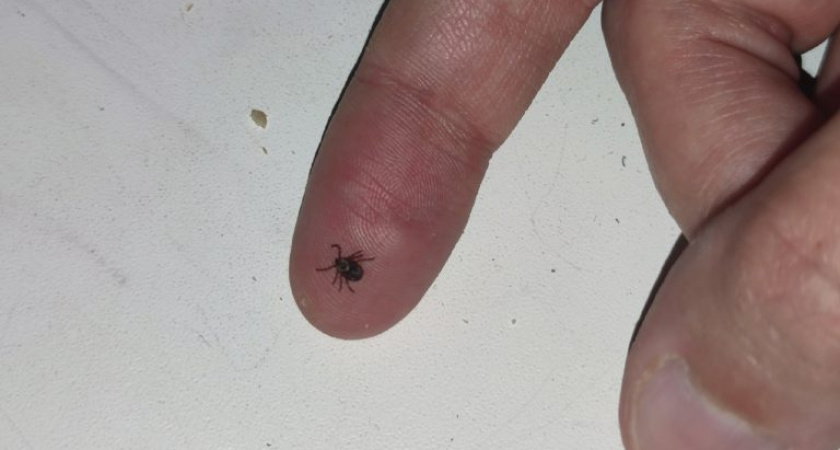 От клещей в Глазове и районе с начала сезона пострадали уже почти 700 человек