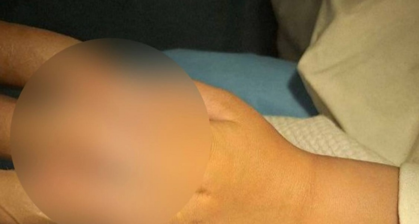 Отрезавшего фалангу пальца ребенка спасли врачи Удмуртии