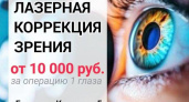 ЛАЗЕРНАЯ КОРРЕКЦИЯ ЗРЕНИЯ в Центре зрения "ОКО"
